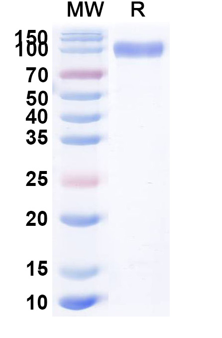 Recombinant protein product