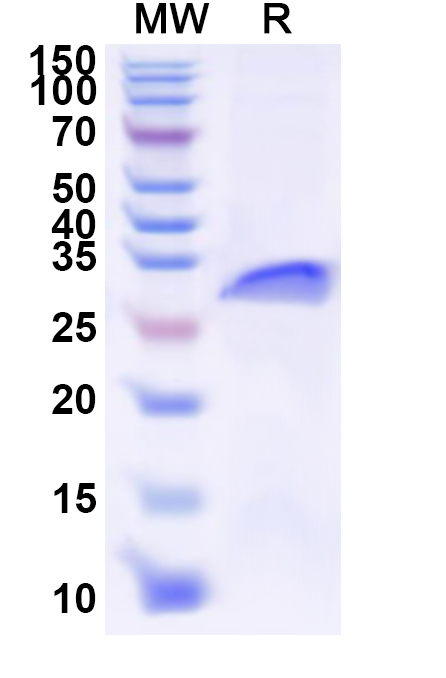 SDS-PAGE for Human EREG Recombinant Protein (N-GST & C-His)