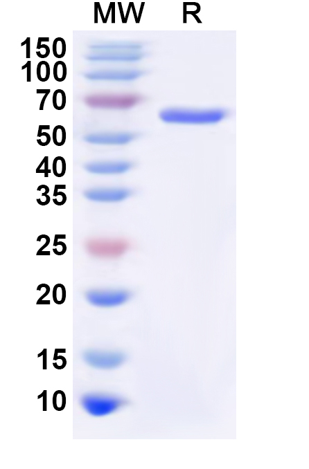 SDS-PAGE for Human GNS Recombinant Protein (N-His)