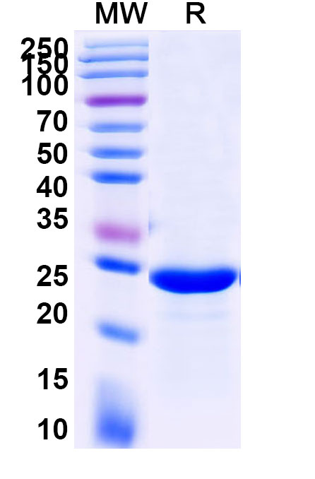 SDS-PAGE for Human IL7 Recombinant Protein (C-His)
