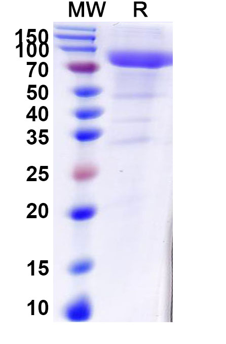 SDS-PAGE for Human KLKB1 Recombinant Protein (C-His)