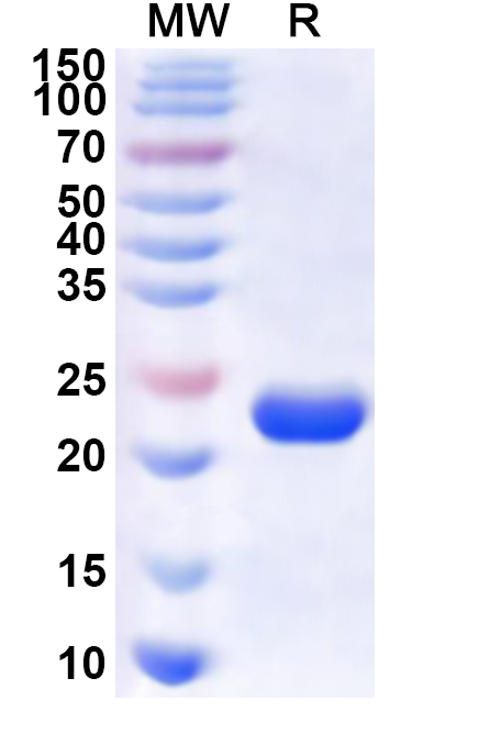 SDS-PAGE for Human LAMC3 Recombinant Protein (N-GST)