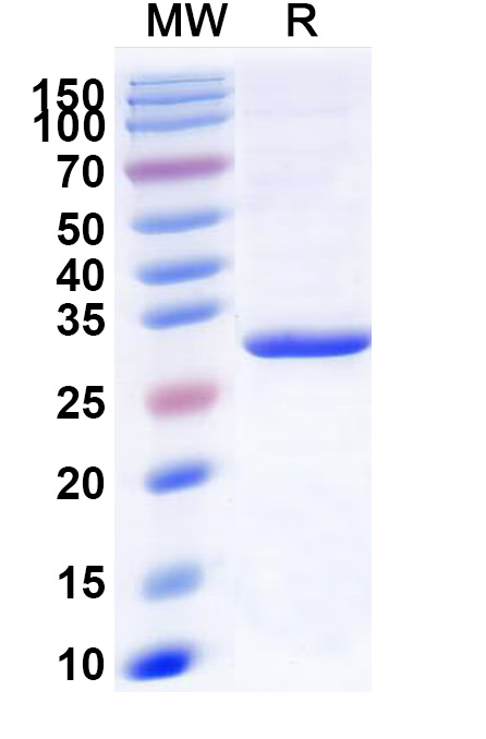 SDS-PAGE for Human LPL Recombinant Protein (N-His)