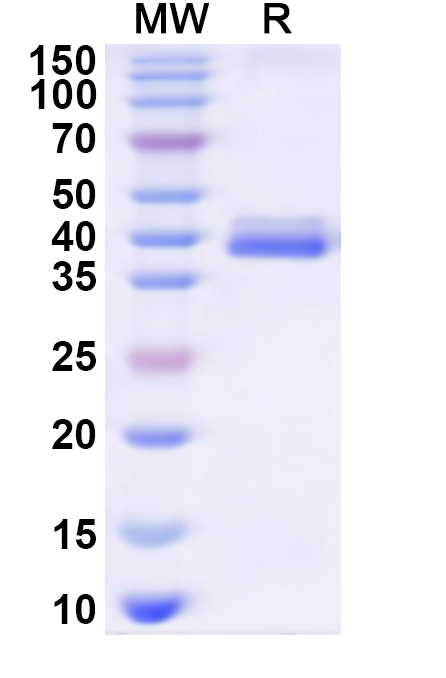 SDS-PAGE for Human MAP3K14 Recombinant Protein (N-His)