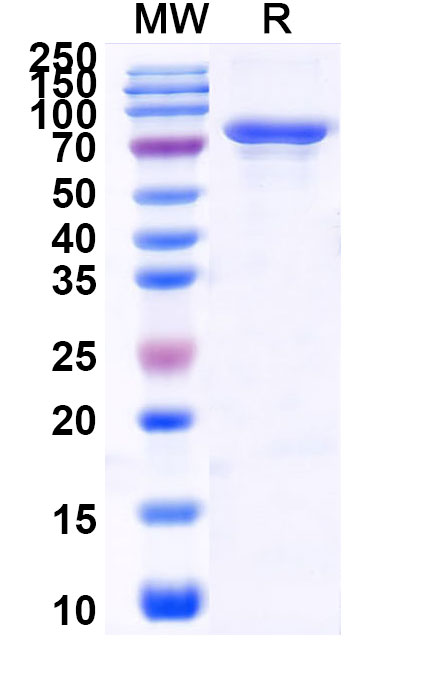 SDS-PAGE for Human METTL3 Recombinant Protein (N-His)
