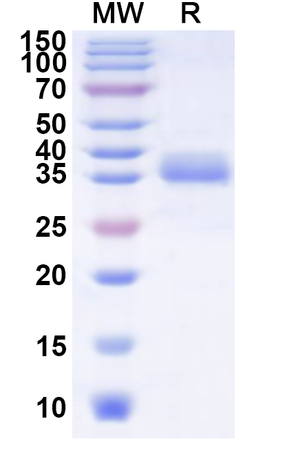 SDS-PAGE for Human NEK2 Recombinant Protein (N-His)