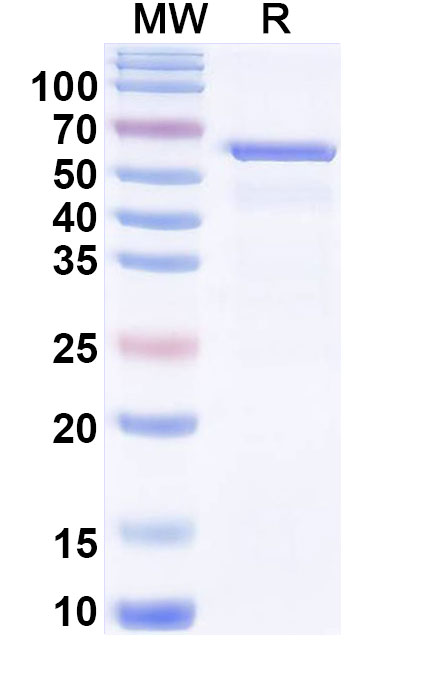 SDS-PAGE for Human NR3C1 Recombinant Protein (N-His)