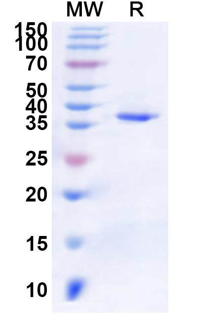 SDS-PAGE for Human OTUD4 Recombinant Protein (N-His)