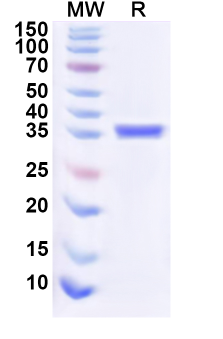 SDS-PAGE for Human PDPN/Podoplanin Recombinant Protein (N-His-KSI)