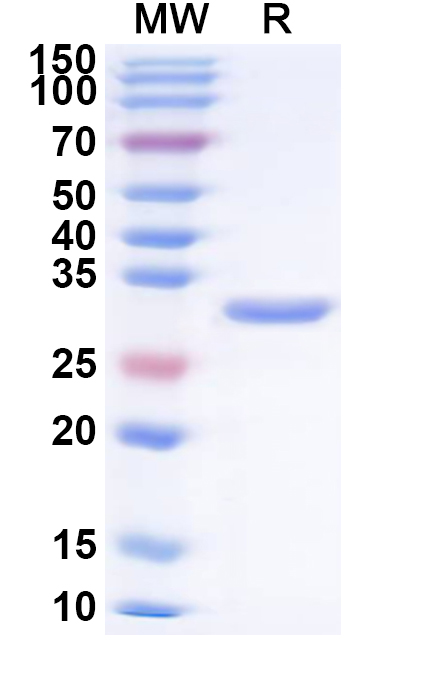 SDS-PAGE for Human PLG/Plasminogen Recombinant Protein (N-His)