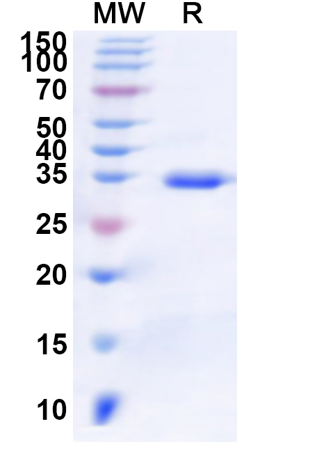SDS-PAGE for Human PRSS8 Recombinant Protein (N-His)