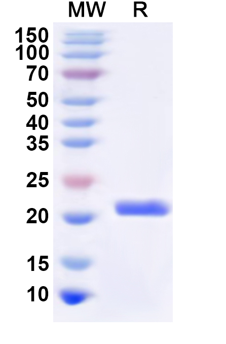SDS-PAGE for Human RPS2 Recombinant Protein (N-His)