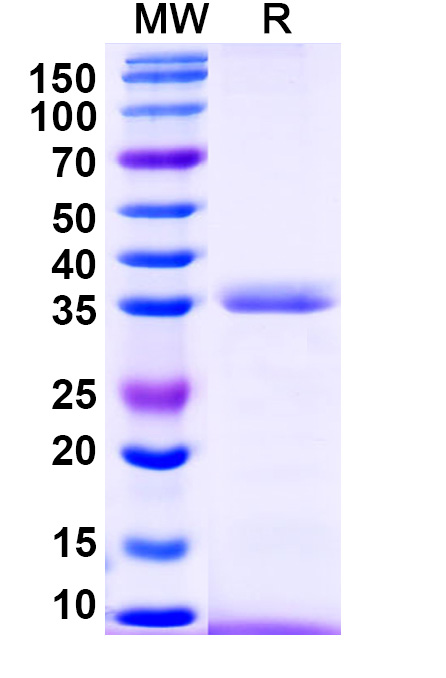 SDS-PAGE for Human SERPINA7 Recombinant Protein (N-His)