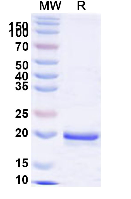 SDS-PAGE for Human SFPQ Recombinant Protein (N-His)