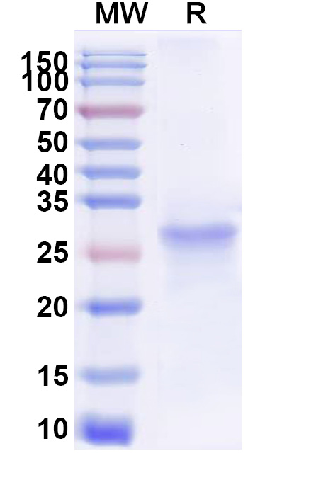 SDS-PAGE for Human SH2B3 Recombinant Protein (N-His)