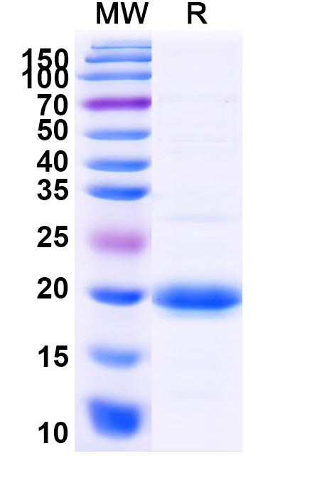 SDS-PAGE for Human SLC10A1 Recombinant Protein (N-His-SUMO)