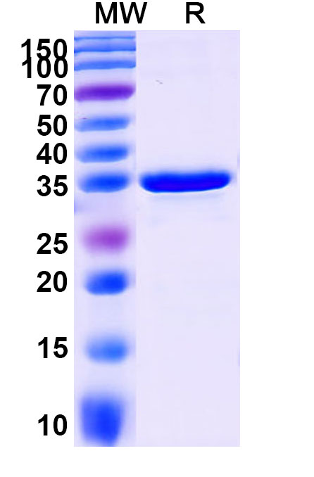 SDS-PAGE for Human SLC2A9 Recombinant Protein (N-GST & C-His)