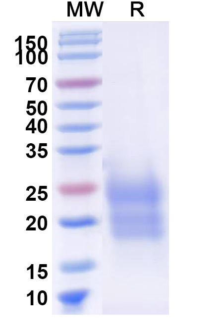 SDS-PAGE for Human TDGF1/CRIPTO Recombinant Protein (C-His)