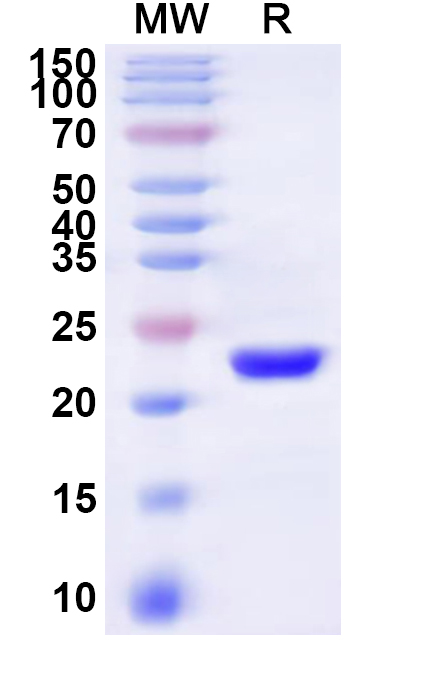 SDS-PAGE for Human TRAM1 Recombinant Protein (N-His-KSI)