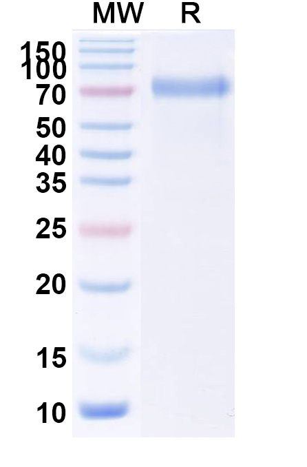SDS-PAGE for Human TSHR/LGR3 Recombinant Protein (C-Fc)