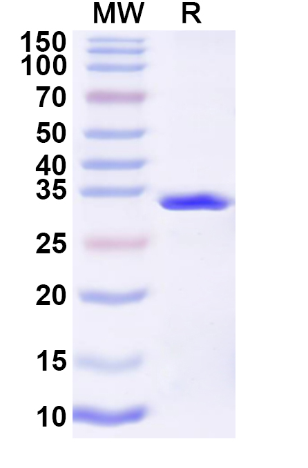 SDS-PAGE for Influenza A virus (H10N7) HA/Hemagglutinin Recombinant Protein (N-His)