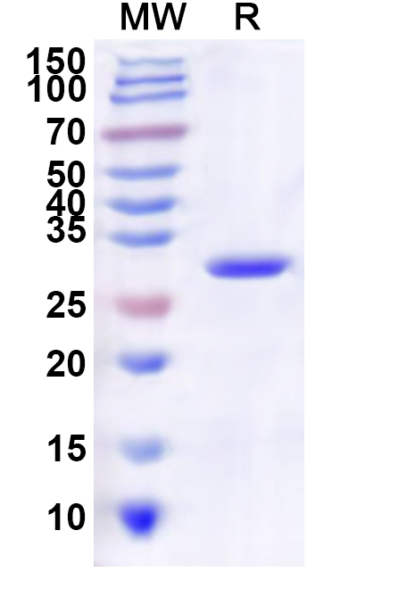 SDS-PAGE for Influenza A virus (H3N2) HA/Hemagglutinin Recombinant Protein (N-His)