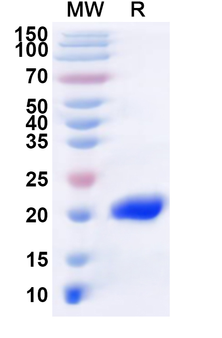 SDS-PAGE for LSDV IMV envelope protein/LSDV060 Recombinant Protein (N-His)