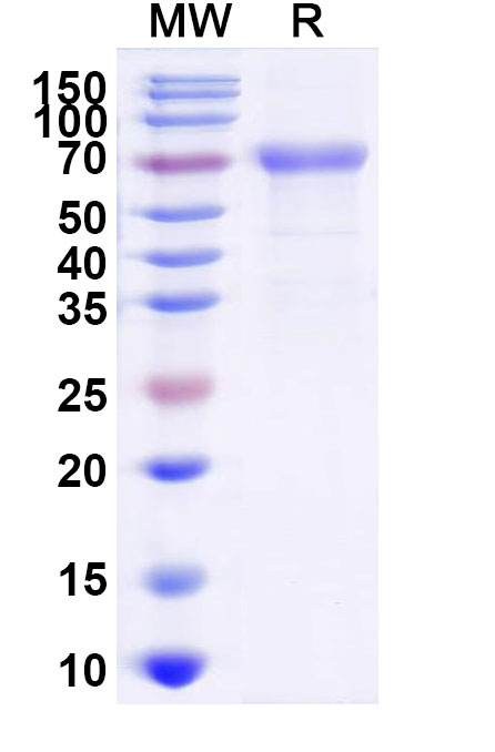 SDS-PAGE for Mojiang virus/MojV G/Glycoprotein Recombinant Protein (C-Strep)
