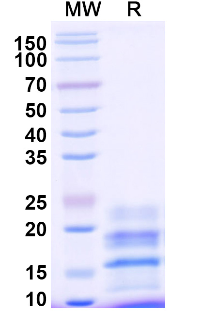 SDS-PAGE for Monkeypox virus/MPXV A29L Recombinant Protein (C-His)