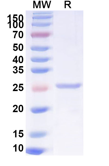 SDS-PAGE for Mouse LAMA2 Recombinant Protein (N-His)
