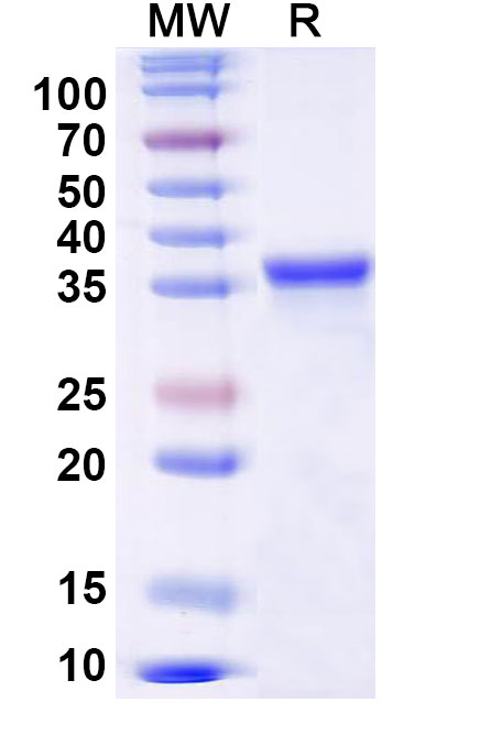 SDS-PAGE for Mouse RIPK1 Recombinant Protein (N-His)