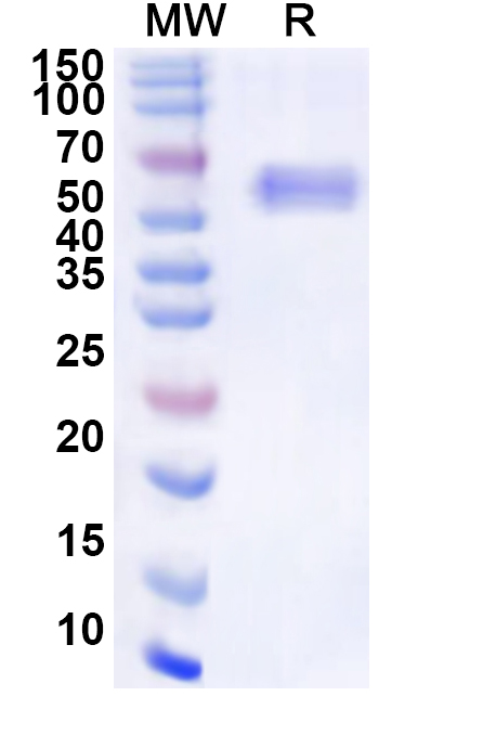 SDS-PAGE for Nipah virus/NiV Recombinant Protein N/Nucleoprotein Protein (N-His)