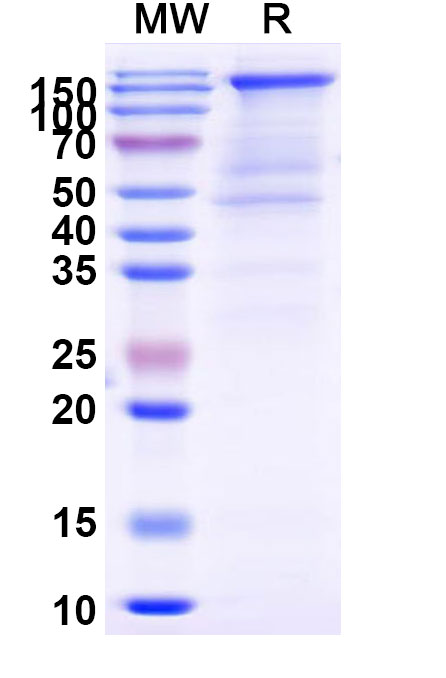 SDS-PAGE for SARS-CoV-2 S Trimer (wt) Recombinant Protein (C-His)