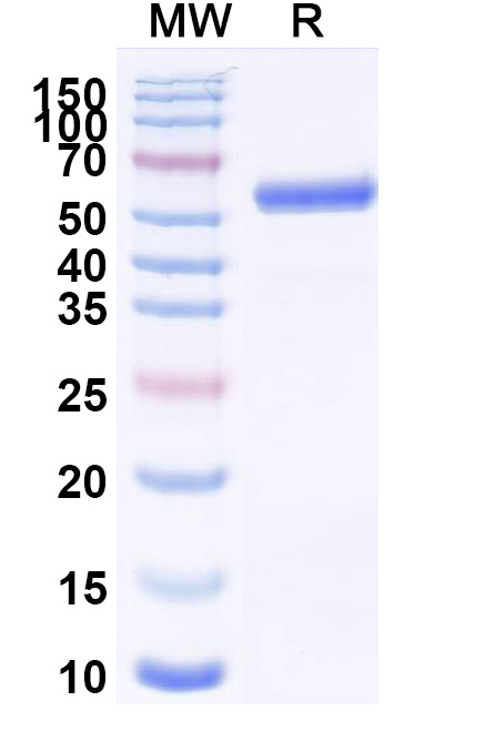 SDS-PAGE for VSIV G protein/Glycoprotein G Recombinant Protein (C-Strep)