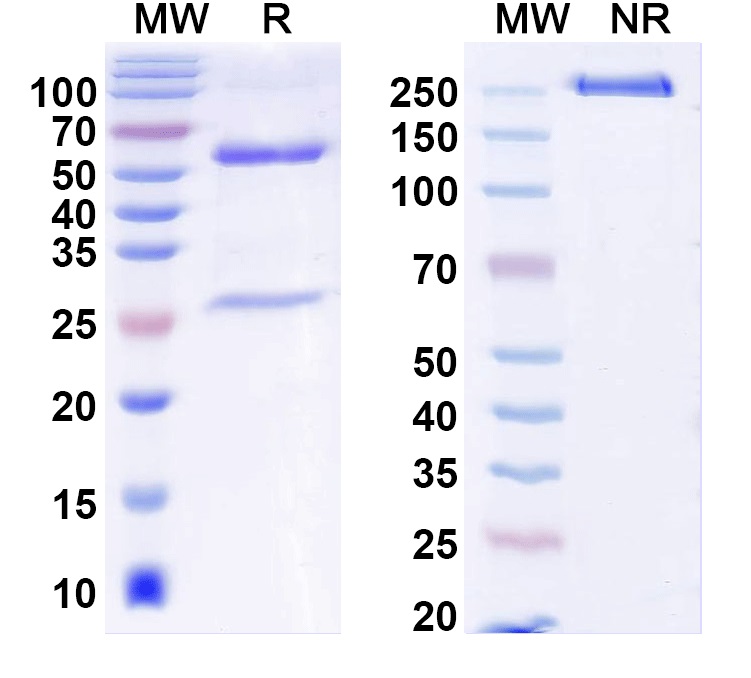 SDS-PAGE for Anti-ANO5/TMEM16E Antibody (N421A/36)