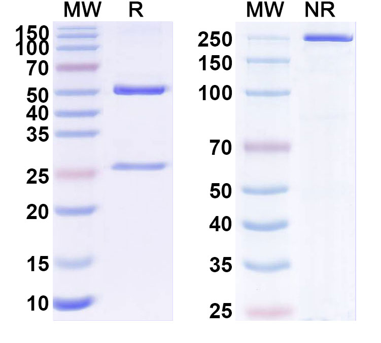 SDS-PAGE for Anti-ANO9/TMEM16J Antibody (N443/75)