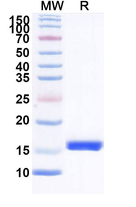 SDS-PAGE for Anti-AZT/Aztreonam Nanobody (SAA1370)
