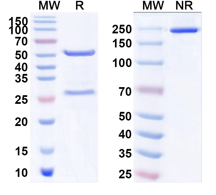 SDS-PAGE for Anti-CDV Protein N/Nucleoprotein Antibody (SAA0844)