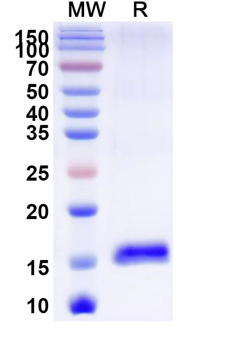 SDS-PAGE for Anti-Castor bean Ricin Nanobody (SAA1001)