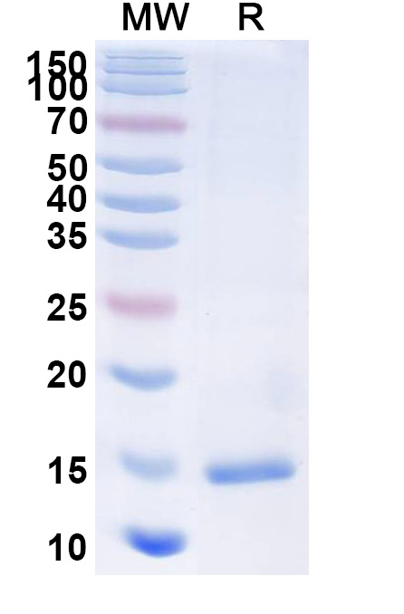 SDS-PAGE for Anti-Castor bean Ricin Nanobody (SAA1097)