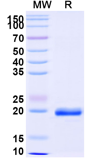 SDS-PAGE for Anti-Castor bean Ricin Nanobody (SAA1148)