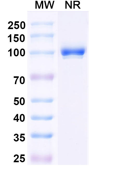 SDS-PAGE for Anti-Clostridium botulinum botA/BOTOX Antibody (Aa1)