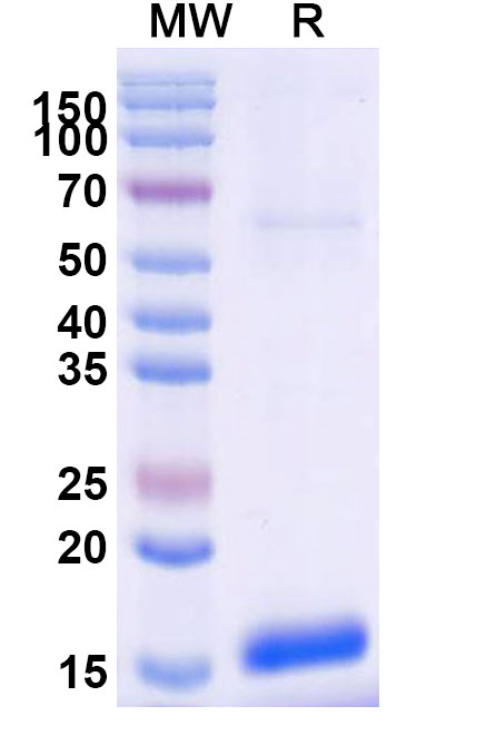 SDS-PAGE for Anti-Clostridium botulinum botA/BOTOX Nanobody (SAA0922)