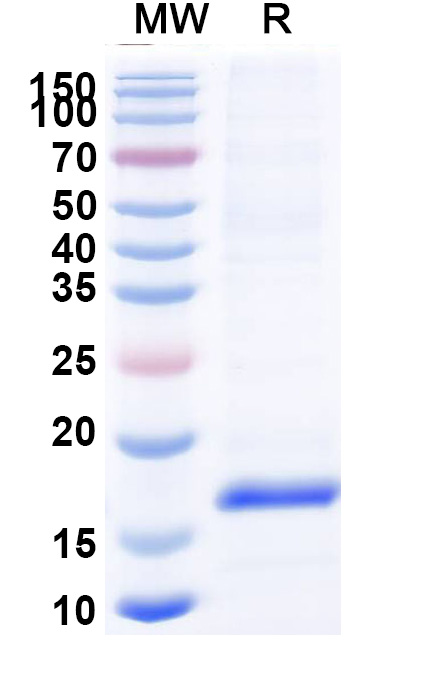 SDS-PAGE for Anti-Clostridium botulinum botA/BOTOX Nanobody (SAA0935)