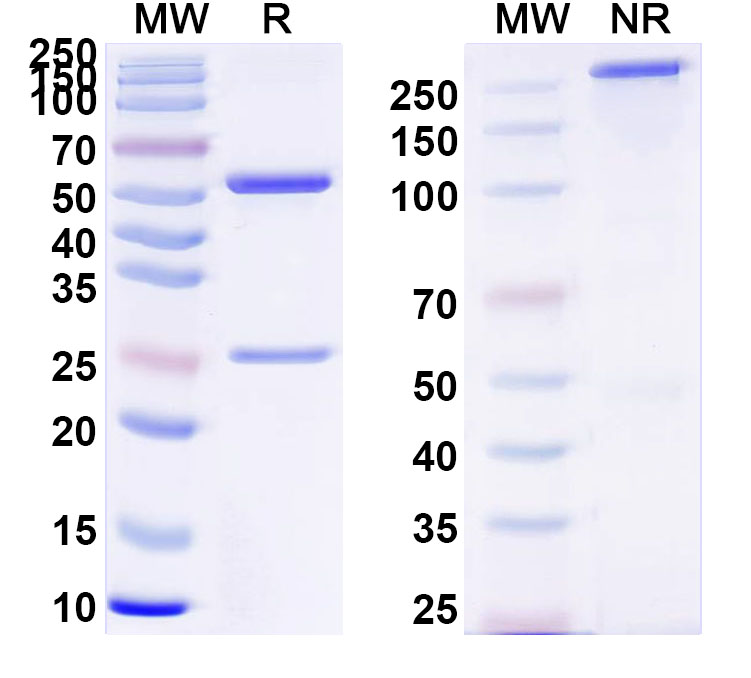SDS-PAGE for Anti-Clostridium tetani tetX/Tetanus toxin Antibody (SAA0862)