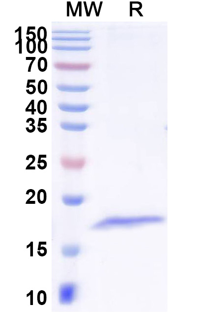 SDS-PAGE for Anti-Clostridium tetani tetX/Tetanus toxin Nanobody (SAA1236)