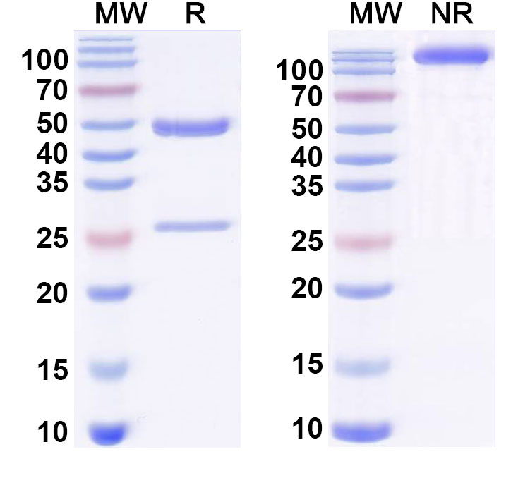 SDS-PAGE for Anti-DNA Antibody (11F8)