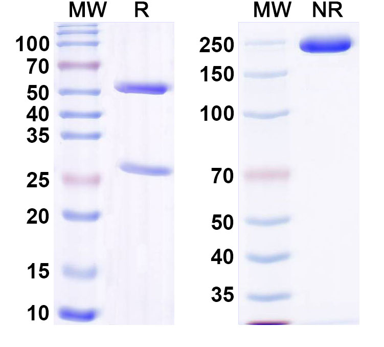 SDS-PAGE for Anti-DNA Antibody (15)