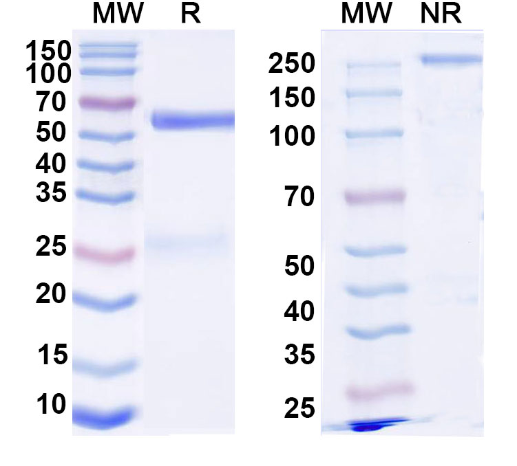 SDS-PAGE for Anti-DNA Antibody (202.17)