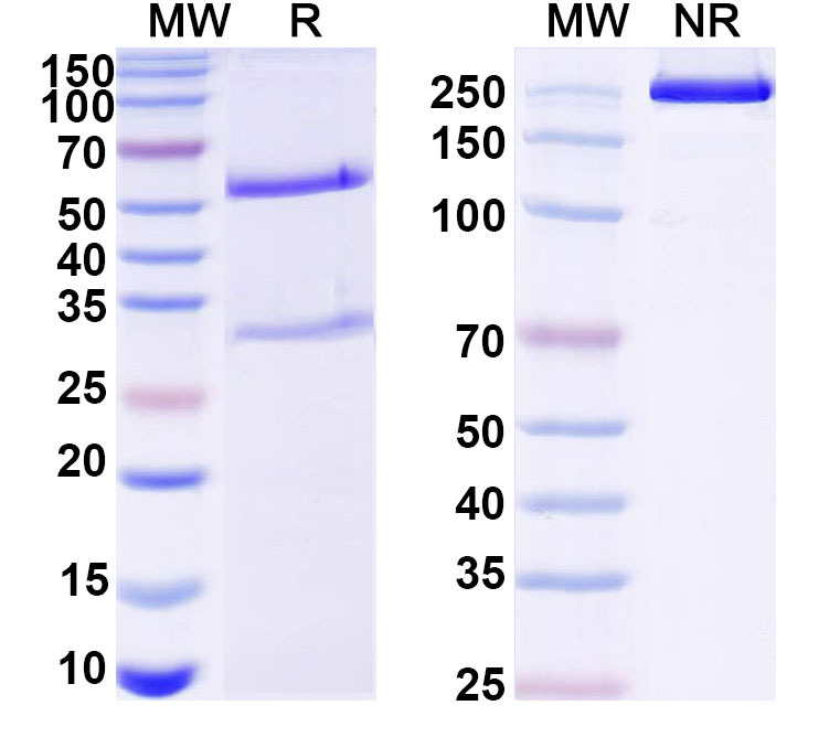 SDS-PAGE for Anti-DNA Antibody (S17.161)
